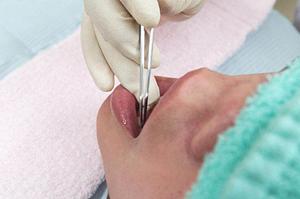 歯並びを天神で快適に綺麗にする方法