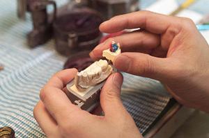 八重歯矯正ならこのクリニックへ