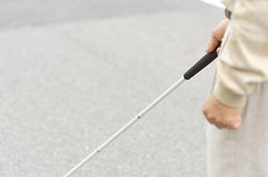 歯の詰め物による金属アレルギーを防止します