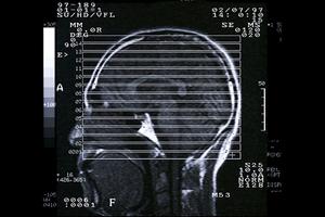 梅田駅近くにある便利な心療内科